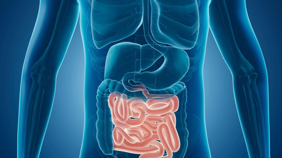 Signs of Crohn's disease