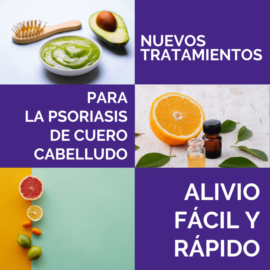 Mejores tratamientos para la psoriasis del cuero cabelludo