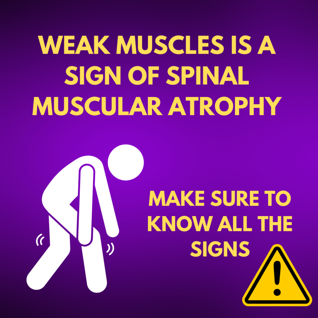 Signs of Spinal Muscular Atrophy (SMA)