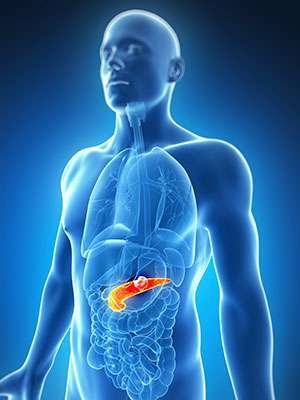 Pancreatic cancer